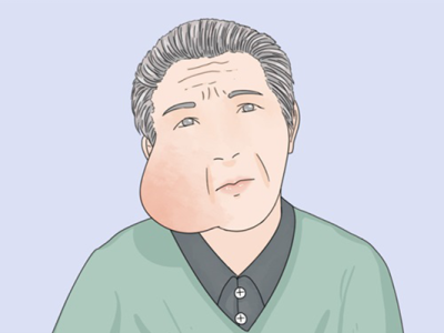 消耗性疾病有哪些