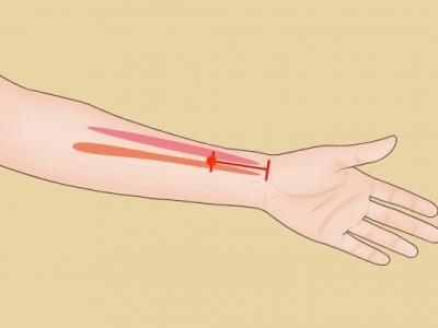 內關穴按摩的好處 按摩內關穴的正確方法