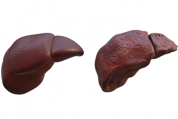 肝硬化能吃羊肉嗎