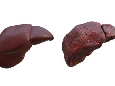 肝硬化能吃羊肉嗎