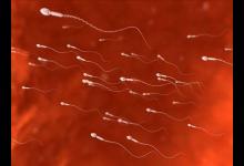 夫妻生活進(jìn)行時(shí)男性出血的原因