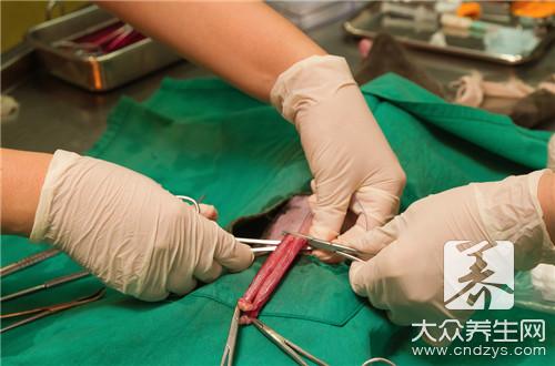 什么時候摘環好