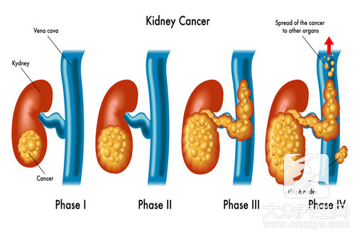 腎跟性功能有關系嗎 腎跟性功能有關系嗎