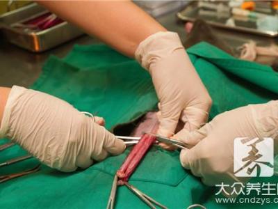 摘環(huán)之前可以同房嗎