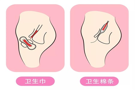 衛生棉條解放女性自由 許多人卻擔心它會弄破處女膜？