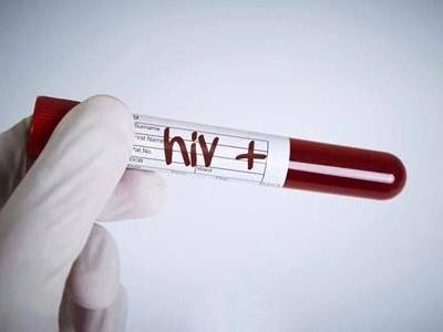 艾滋病并沒有初期癥狀，如何預(yù)防艾滋病要記住這一點(diǎn)