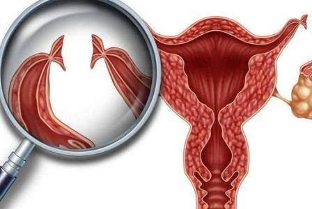 二胎剖腹產(chǎn)后做結(jié)扎手術(shù) 結(jié)扎對(duì)女性身體影響有多大-易網(wǎng)健康養(yǎng)生網(wǎng) 二胎剖腹產(chǎn)后做結(jié)扎手術(shù) 結(jié)扎對(duì)女性身體影響有多大