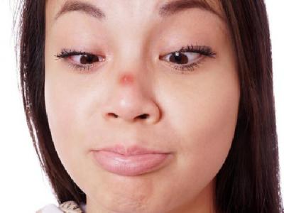 體外射精避孕法為何不靠譜 體外射精避孕的優(yōu)點(diǎn)都有哪些