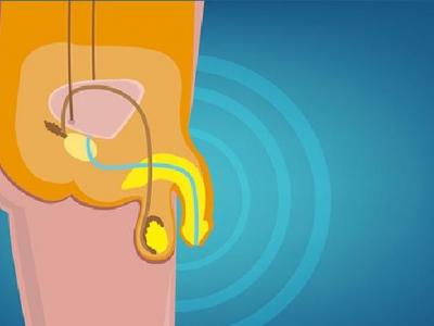男性遺精誘發(fā)因素有哪些 你知道什么情況屬于遺精嗎