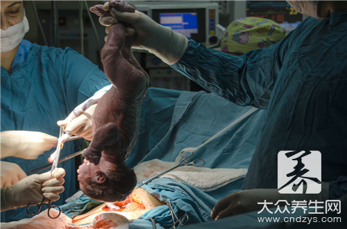 無痛引產術手術流程