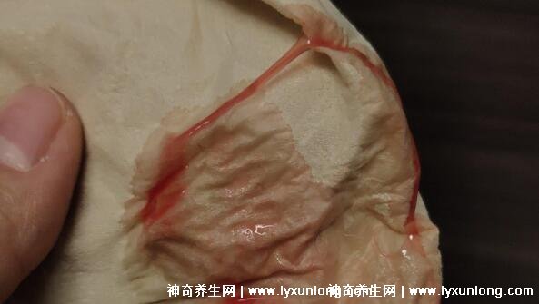 懷孕剛著床的6個反應，月經前一星期懷孕跡象(附著床出血圖片)