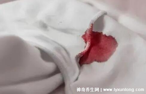 宮頸癌褐色分泌物圖片，少量不規(guī)則出血伴隨X交痛(腥臭分泌物)