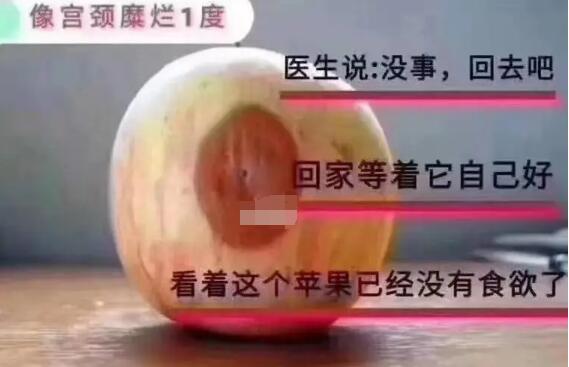 宮頸糜爛一二三度圖片，真實對比照片(小心是宮頸癌前兆)