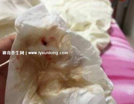 真實宮頸癌的早期出血圖片，接觸性出血是最明顯癥狀(女性必看)