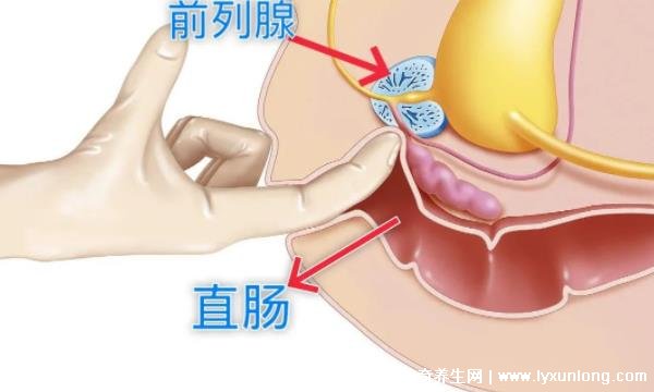 30秒自測前列腺炎，是否出現尿痛/尿頻/尿急(附自測方式)