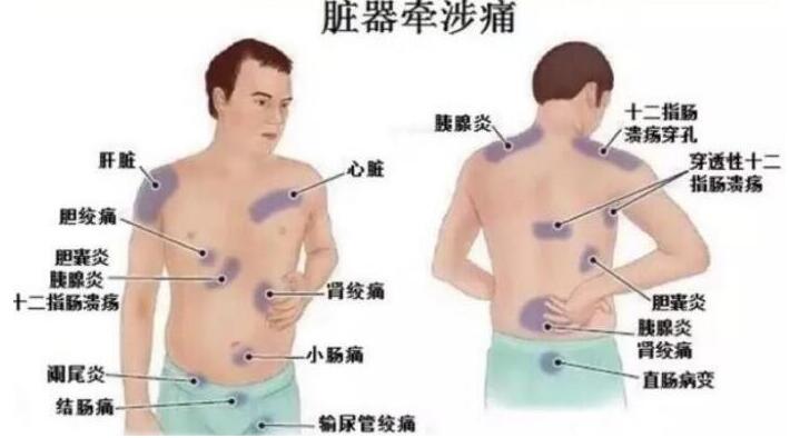 女性后背疼警惕四種病，腰部周圍痛小心婦科病(疼痛位置圖解)