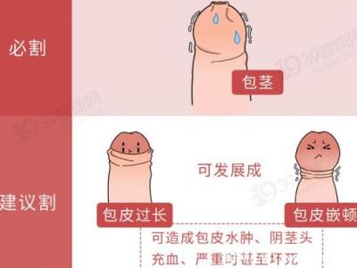 成年男子割包好處和壞處，8種情況必須割(附割包照片真實)