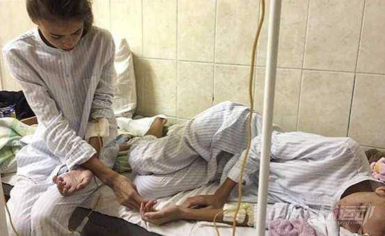 為成為模特這對雙胞胎做了這件事，患上厭食癥還成了“老奶奶”