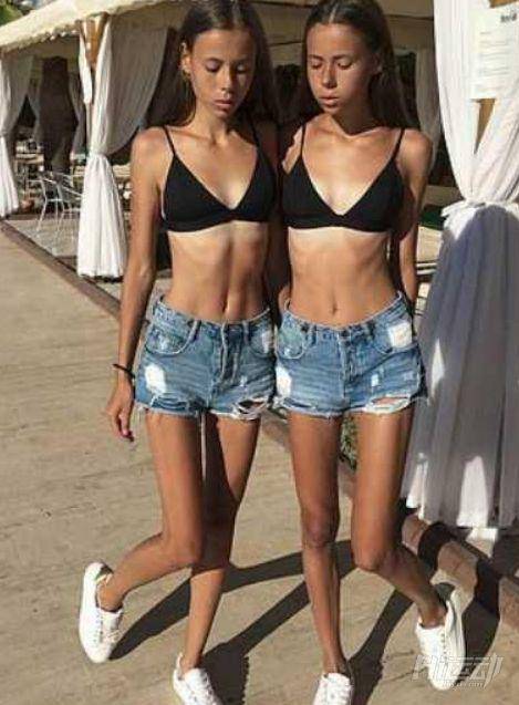 為成為模特這對雙胞胎做了這件事，患上厭食癥還成了“老奶奶”