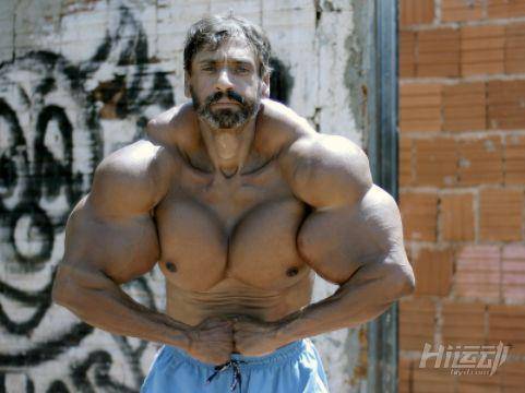 為追求更大的肌肉男子不惜代價(jià)，注射燃油手臂足有60cm粗