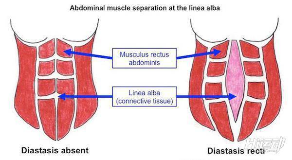 產(chǎn)后肚子變松弛，常規(guī)減脂不頂用！3步找回平坦腹肌