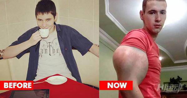 俄羅斯小伙靠“隆”手臂成網紅？用生命在作死！手臂爆了