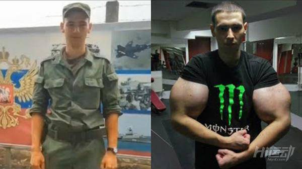 俄羅斯小伙靠“隆”手臂成網紅？用生命在作死！手臂爆了