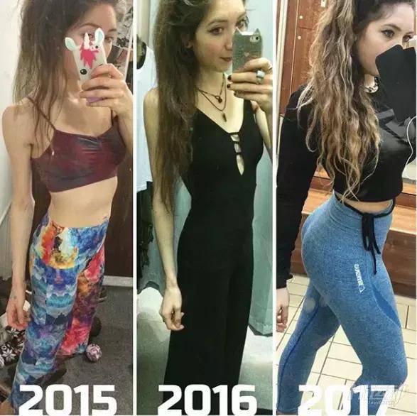 極致追求瘦身，反而患上疾病，一天嘔吐14次