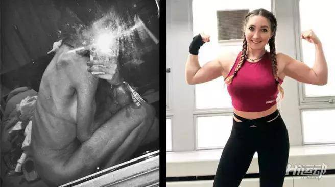 極致追求瘦身，反而患上疾病，一天嘔吐14次