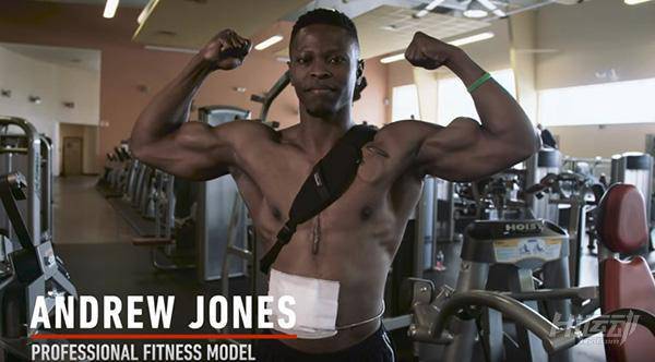 每天先充電才能活！小伙靠人工心臟續命，依然堅持健身