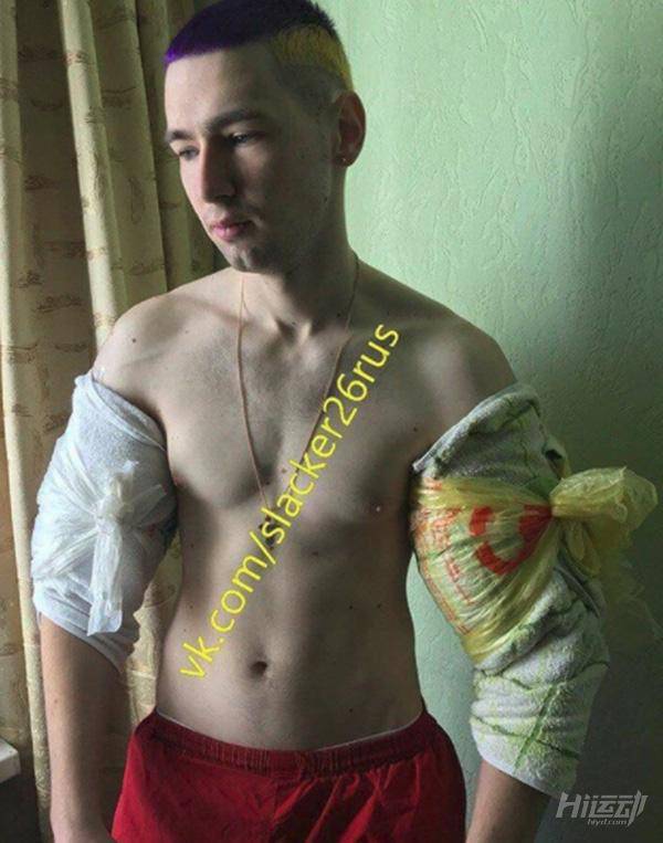 俄羅斯小伙靠“隆”手臂成網紅？用生命在作死！手臂爆了