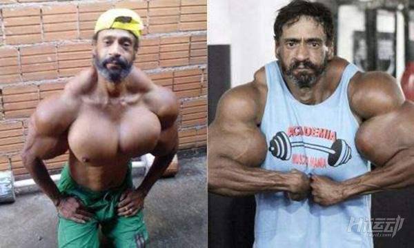 俄羅斯小伙靠“隆”手臂成網紅？用生命在作死！手臂爆了