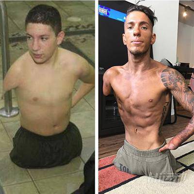 出生只有一只胳膊一條腿，身材卻比正常人都強(qiáng)百倍！