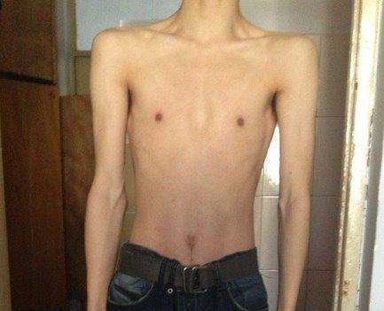 80斤瘦弱男生鍛煉變男神的增肌故事