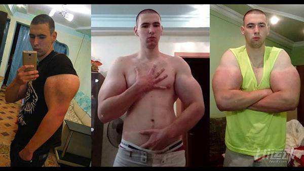 俄羅斯小伙靠“隆”手臂成網紅？用生命在作死！手臂爆了