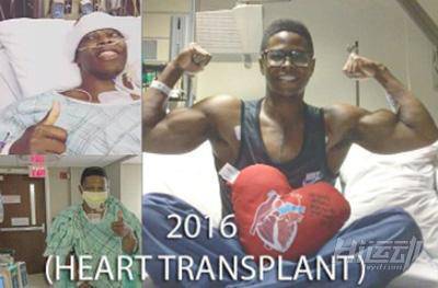 每天先充電才能活！小伙靠人工心臟續命，依然堅持健身