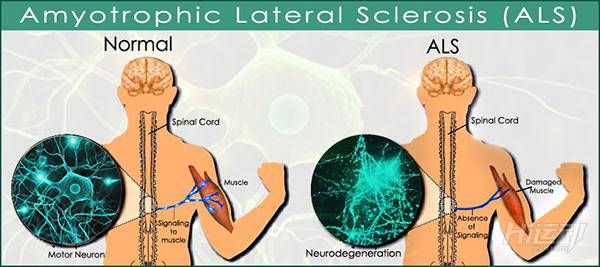 巨人隕落，史蒂芬?霍金與運動的不解情緣