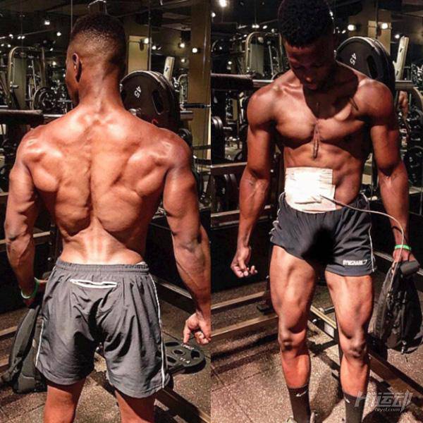 每天先充電才能活！小伙靠人工心臟續命，依然堅持健身