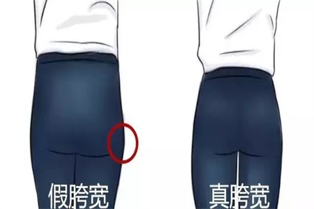 是翹臀還是假胯寬，女性可以練習這三組瑜伽動作來改善