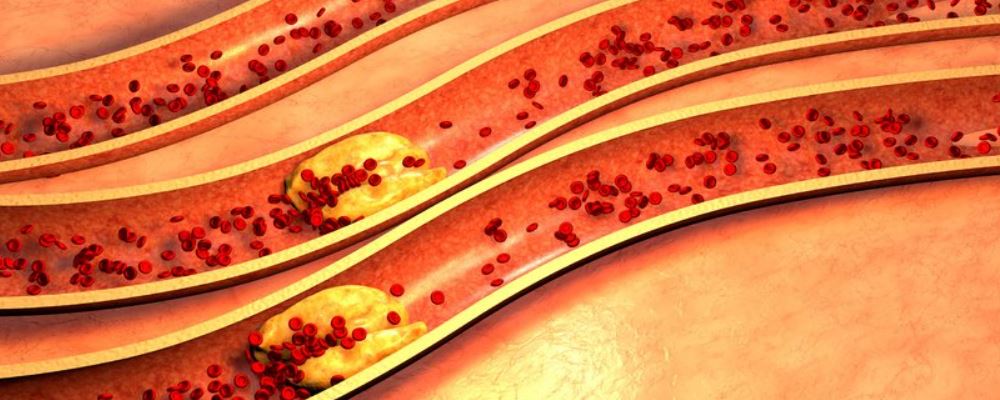 世界上最胖的人減了660斤 肥胖有哪些危害