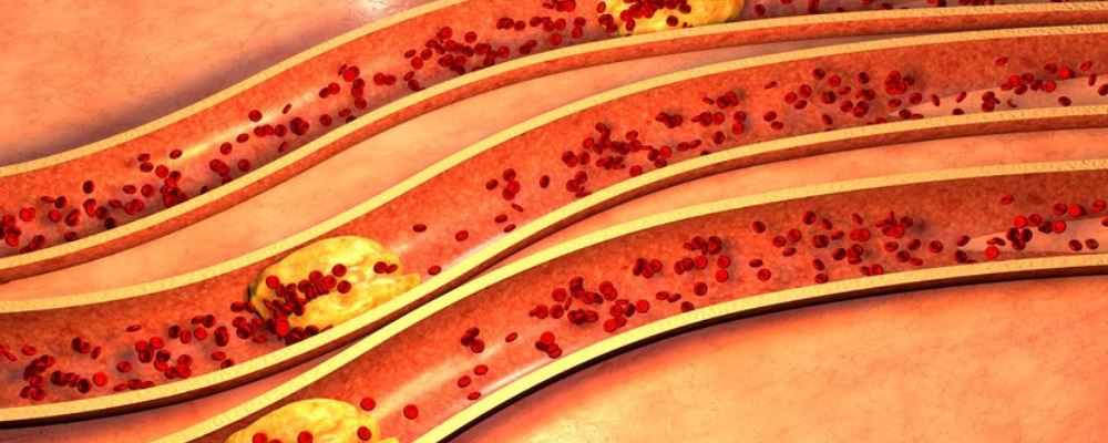 疫情期間去跑步 這幾點(diǎn)要注意