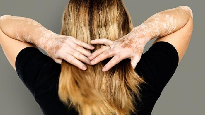 飲食減肥主食如何選 飲食減肥主食怎么選