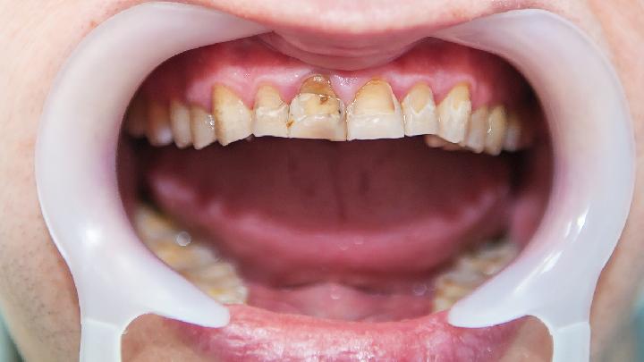 6種飲食減肥偏方原理 6種飲食減肥方法原理