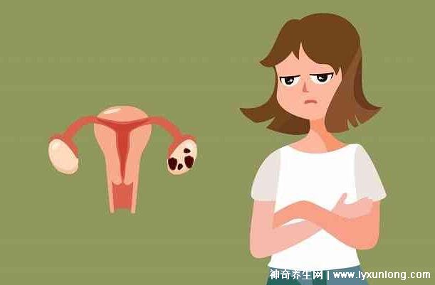 子宮肌瘤最怕三個運動，激烈的運動和夫妻生活導致肌瘤增大