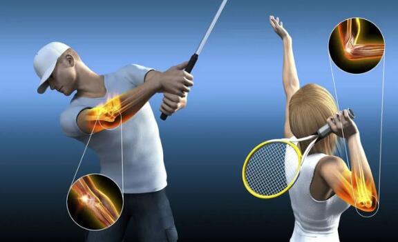 網(wǎng)球肘最怕三個動作，反手拍球/手腕彎曲/提重物/做家務(wù)