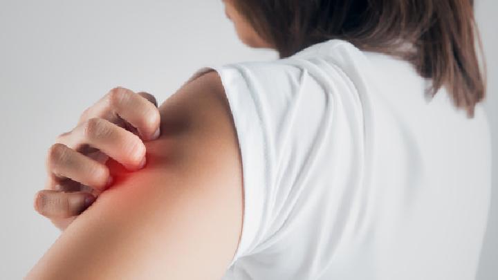 跳繩能減肥嗎？跳繩消耗能量減肥效果好嗎？