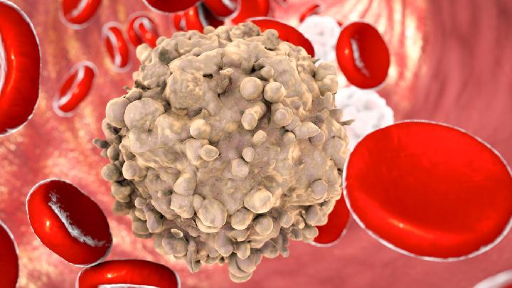 小產后能減肥嗎？小產后的注意事項有什么？