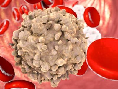 小產后能減肥嗎？小產后的注意事項有什么？