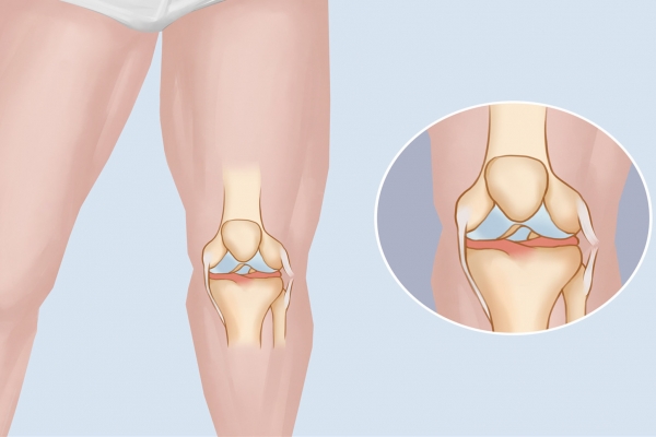 半馬對(duì)身體有損傷嗎