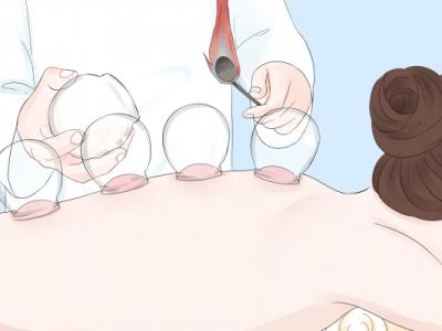 拔火罐可以減肥嗎